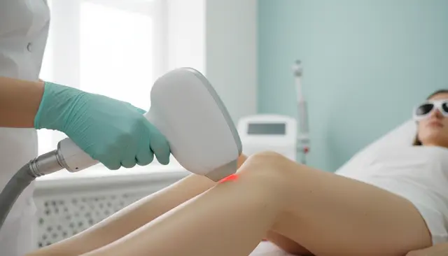 Epilare definitivă laser